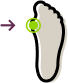 Illustration of a foot with a bunion, highlighting the affected joint area.
