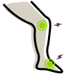 Illustration representing fibromyalgia pain points and symptoms relevant to footwear comfort solutions.