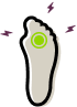 Illustration showing the location and nerve compression associated with Morton's Neuroma in the foot.